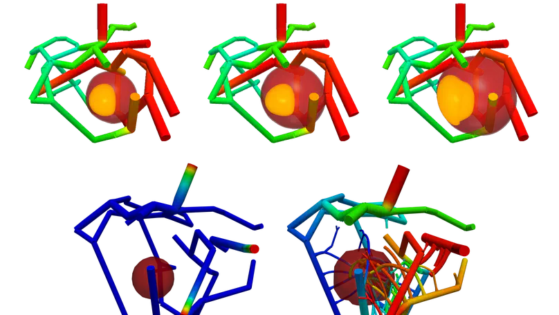 Modeling tumor growth, angiogenesis, drug-therapy, metastasis